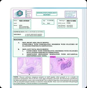 Complex Layout Extraction